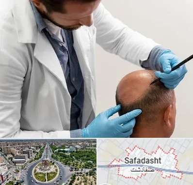 کاشت مو به روش تکثیری در صفادشت