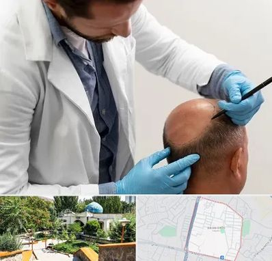کاشت مو به روش تکثیری در باغمیشه تبریز