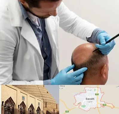 کاشت مو به روش تکثیری در ساوه