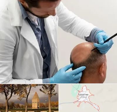 کاشت مو به روش تکثیری در تویسرکان