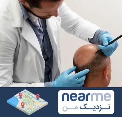 کاشت مو به روش تکثیری در نزدیک من