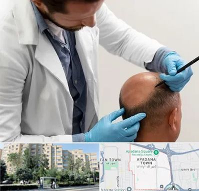 کاشت مو به روش تکثیری در آپادانا