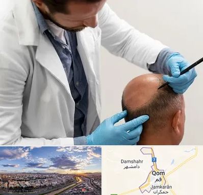 کاشت مو به روش تکثیری در قم