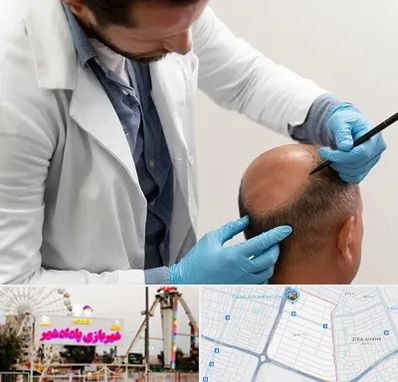 کاشت مو به روش تکثیری در پادادشهر اهواز