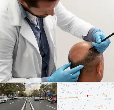 کاشت مو به روش تکثیری در دولت 