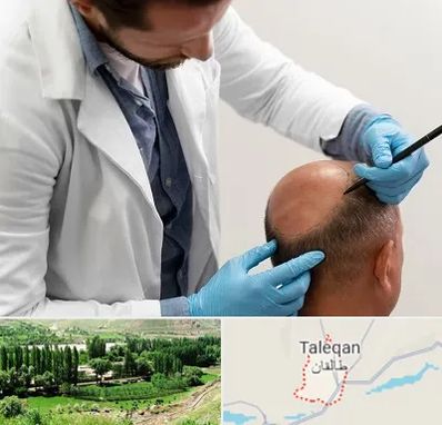 کاشت مو به روش تکثیری در طالقان