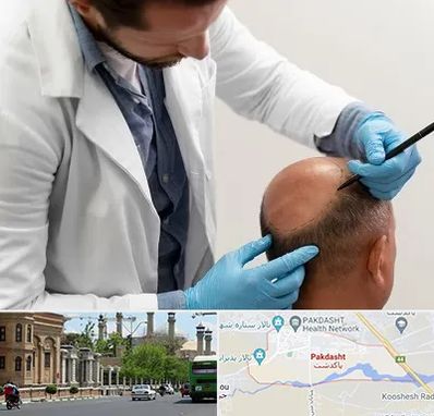 کاشت مو به روش تکثیری در پاکدشت