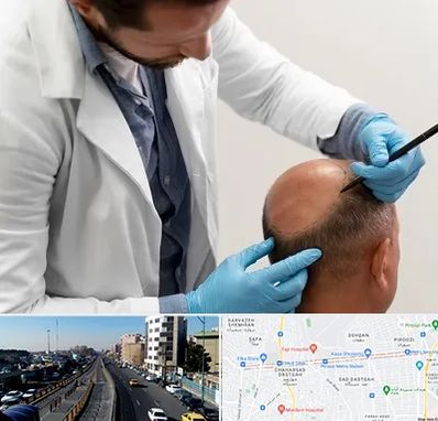 کاشت مو به روش تکثیری در پیروزی 