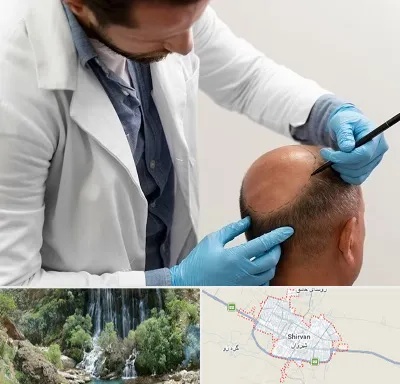 کاشت مو به روش تکثیری در شیروان