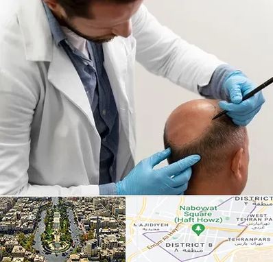 کاشت مو به روش تکثیری در نارمک 