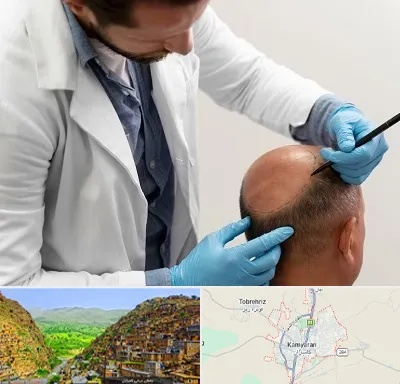 کاشت مو به روش تکثیری در کامیاران