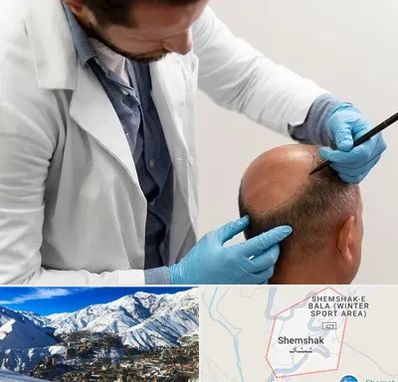 کاشت مو به روش تکثیری در شمشک
