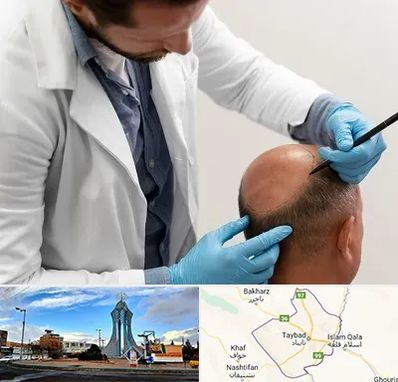 کاشت مو به روش تکثیری در تایباد