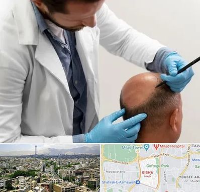 کاشت مو به روش تکثیری در گیشا 