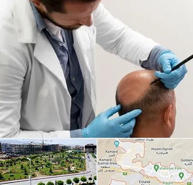 کاشت مو به روش تکثیری در پردیس