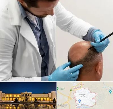 کاشت مو به روش تکثیری در برازجان