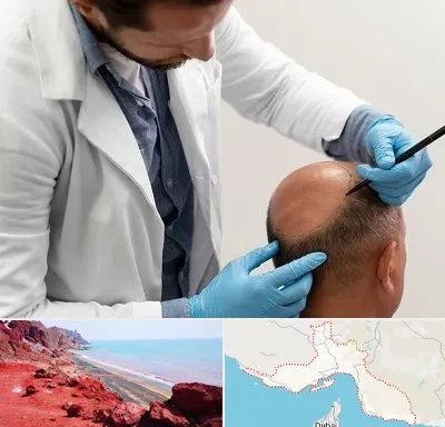 کاشت مو به روش تکثیری در هرمزگان