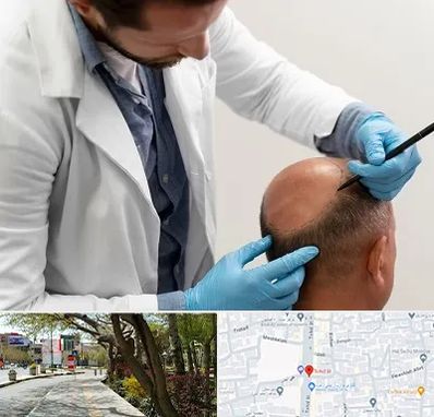 کاشت مو به روش تکثیری در خیابان توحید اصفهان