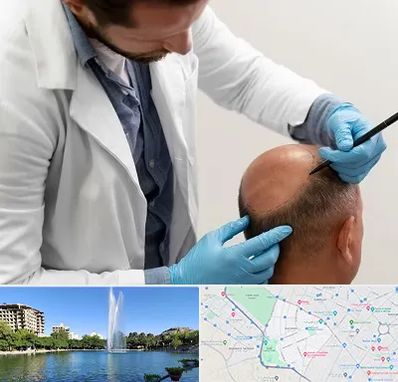 کاشت مو به روش تکثیری در کوهسنگی مشهد