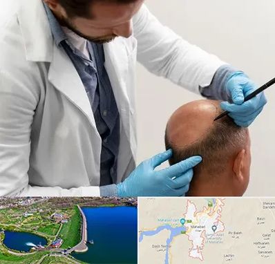 کاشت مو به روش تکثیری در مهاباد