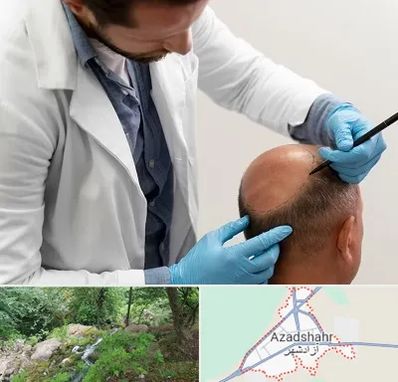 کاشت مو به روش تکثیری در آزادشهر