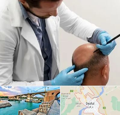 کاشت مو به روش تکثیری در دزفول