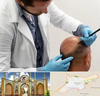 کاشت مو به روش تکثیری در سمنان