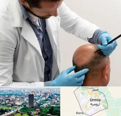 کاشت مو به روش تکثیری در ارومیه