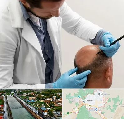 کاشت مو به روش تکثیری در مراغه