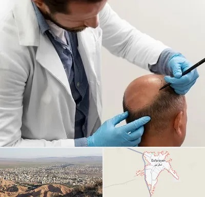 کاشت مو به روش تکثیری در اسفراین