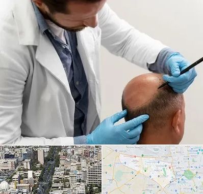 کاشت مو به روش تکثیری در منطقه 18 تهران 