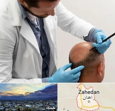 کاشت مو به روش تکثیری در زاهدان