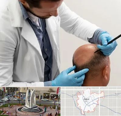 کاشت مو به روش تکثیری در زابل