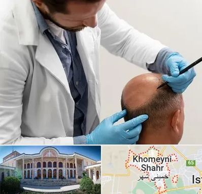 کاشت مو به روش تکثیری در خمینی شهر