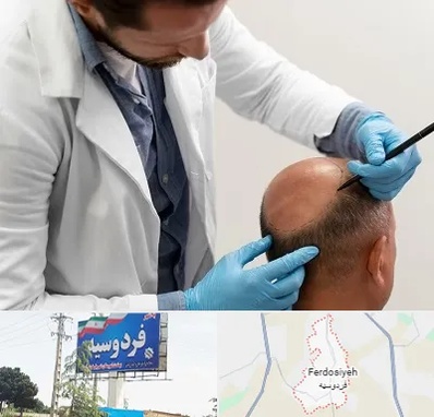 کاشت مو به روش تکثیری در فردوسیه شهریار