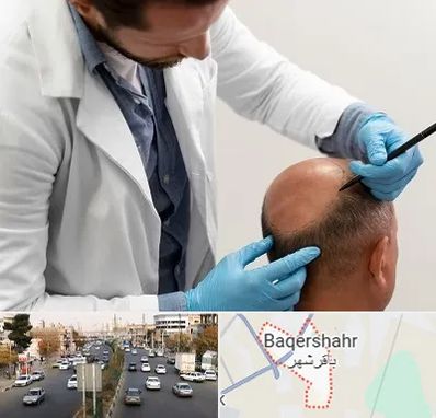 کاشت مو به روش تکثیری در باقرشهر