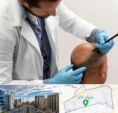 کاشت مو به روش تکثیری در سعادت آباد 