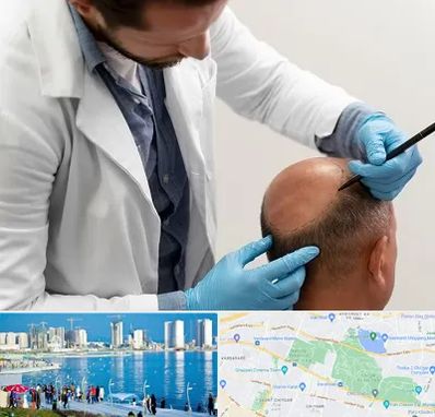 کاشت مو به روش تکثیری در چیتگر 