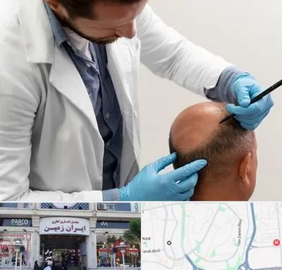 کاشت مو به روش تکثیری در ایران زمین