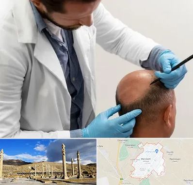 کاشت مو به روش تکثیری در مرودشت