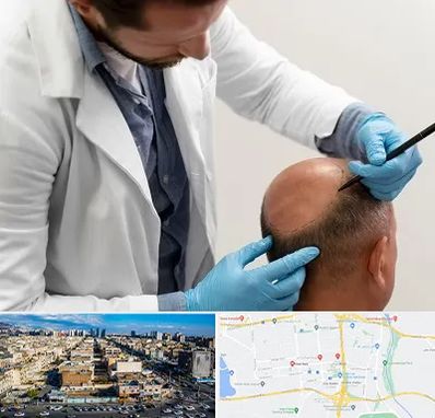 کاشت مو به روش تکثیری در شهرک راه آهن