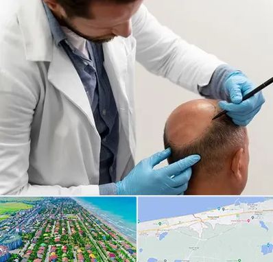 کاشت مو به روش تکثیری در فریدونکنار