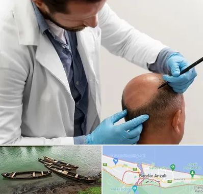 کاشت مو به روش تکثیری در بندر انزلی