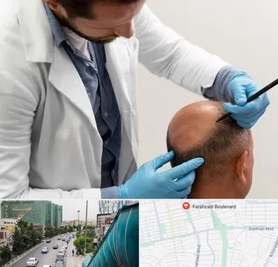 کاشت مو به روش تکثیری در بلوار فرحزادی