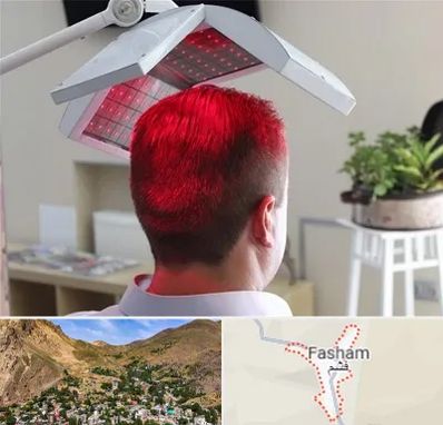 کاشت مو با لیزر در فشم