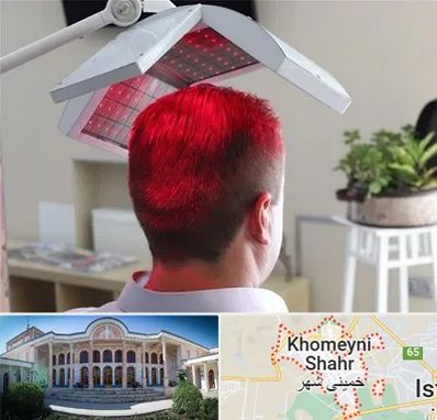 کاشت مو با لیزر در خمینی شهر