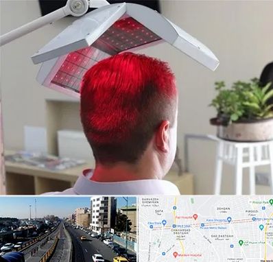 کاشت مو با لیزر در پیروزی 