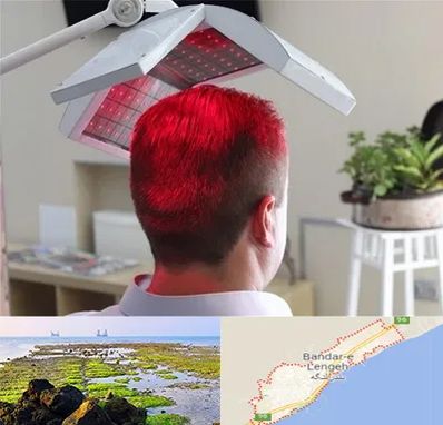 کاشت مو با لیزر در بندرلنگه