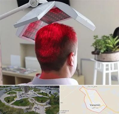 کاشت مو با لیزر در ورامین