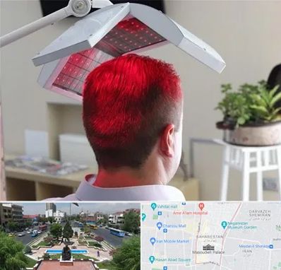 کاشت مو با لیزر در بهارستان 